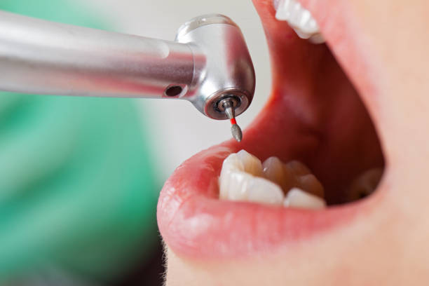 Best Holiday Emergency Dentist in New Deal, TX